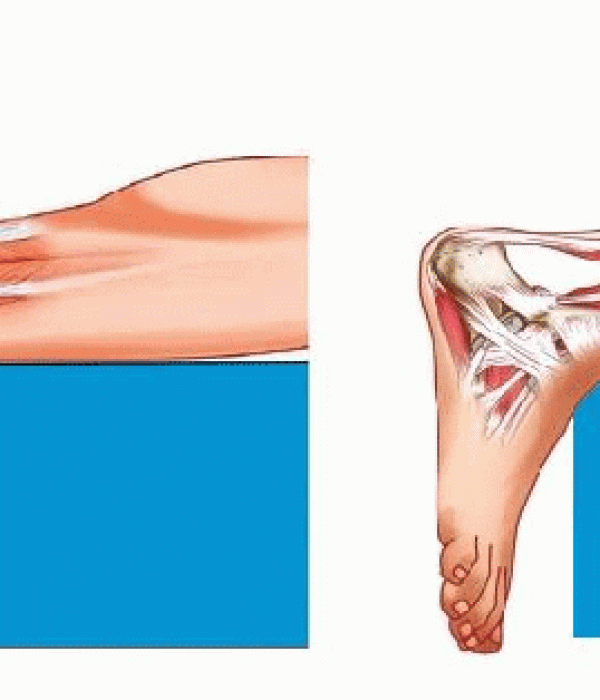 Wave therapy infographic outlining treatment benefits, healing process, and pain relief in Marysville, Ohio